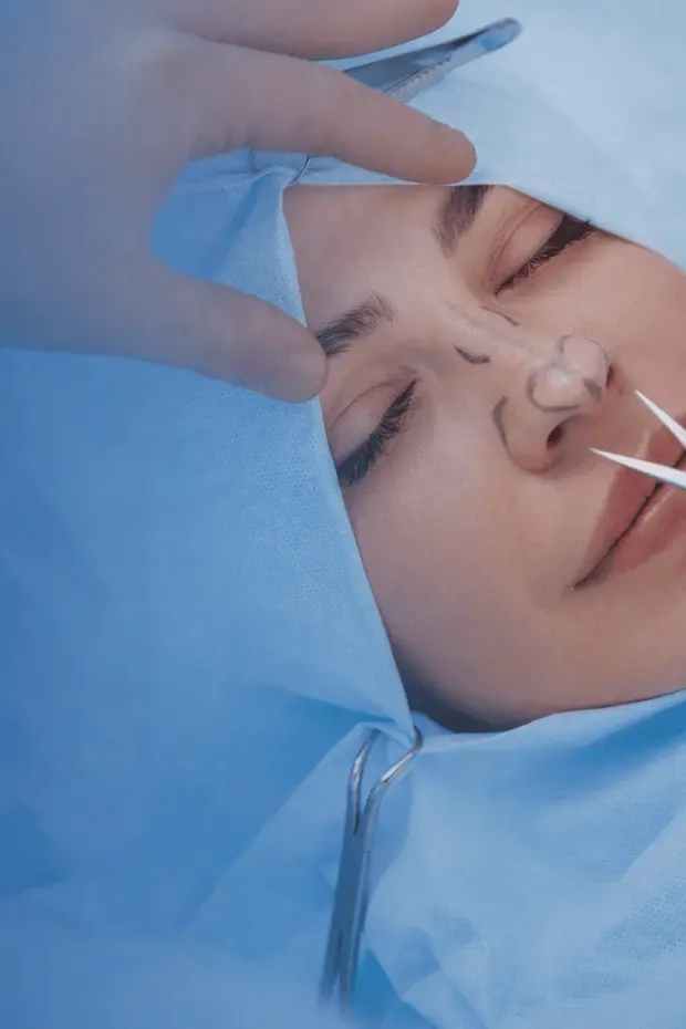 Rhinoplasty surgery procedure by Dr. Rasit Cevizci