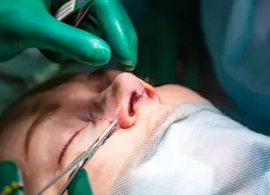 Rhinoplasty surgery day in Istanbul hospital