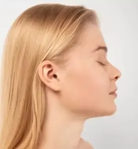 Post-operative rhinoplasty follow-up and recovery care